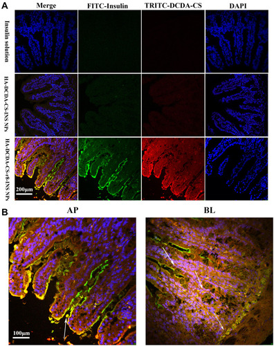 Figure 9 Intestinal sections in vitro. (A). Representative fluorescence-based images of intestinal villi after administration of fluorescently-labeled NPs in TID rats. Insulin was labeled with FITC, DCDA-CS was labeled with TRITC, and the nucleus was stained with DAPI. (B). White arrows indicate where HA-DCDA-CS-r8-INS NPs have been absorbed into the intestinal villi (yellow fluorescence).