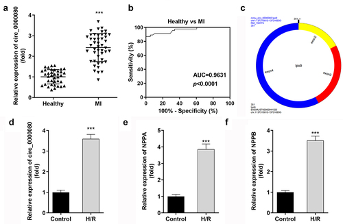 Figure 1. Circ_0000080 is upregulated in patients with MI and in H/R-treated cells. (a) circ_0000080 was upregulated in patients with MI. (b) ROC analysis for the distinction between patients with MI and healthy controls. (c) The information of circ_0000080. (d) The circ_0000080 level was analyzed by qRT-PCR after H/R treatment (n = 3). (e) Detection of NPPA expression in H/R cells (n = 3). (f) Detection of NPPA expression in H/R cells (n = 3). **p < 0.01, ***p < 0.001.