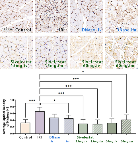 Figure 5 Histone H3 levels 24 h after ischemia-reperfusion injury in rat hindlimb muscles. H3 decreased after administration of DNAse-I or sivelestat. n=5, data are expressed as mean ± standard deviation, *P < 0.05, ***P < 0.001. Scale bar = 100 μm.