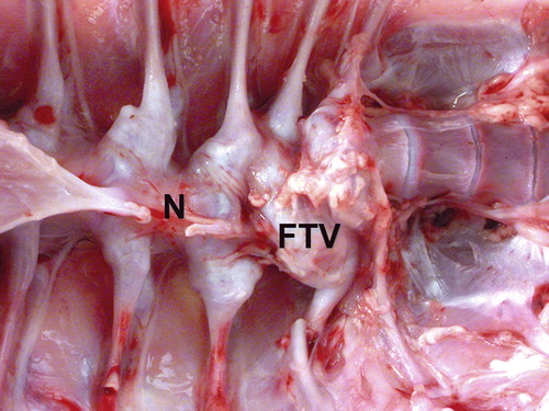 Figure 4.  Spine of a 39-day-old female turkey that was culled due to stunting and lameness with vertebral chondrodystrophy. The caudal thoracic vertebrae are severely deformed because of lesions in the caudal notarium (N) and free thoracic vertebra (FTV). Mycoplasma iowae was isolated from the intervertebral space within the lesion.