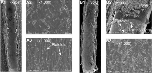 Figure 4 Scanning electron microscope images of the luminal surface of the iliac artery.