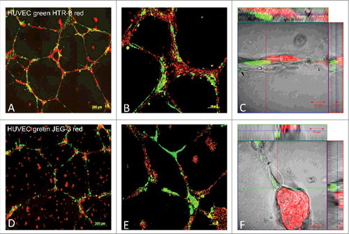 Figure 1. Fluorescence images of co-localisation and migration of HTR-8/SVneo cells, compared with JEG-3 cells, to pre-formed endothelial cell tubes in Matrigel®. HUVEC cell culture networks in Matrigel® (labelled with cytoplasma marker CellTracker™ Green CMFDA Dye, Invitrogen™) were established for 24h, before co-culture with HTR-8/SVneo (panels A-C) or JEG-3 cells (D-F) for 24 h to evaluate cell migration and co-localisation patterns. Both HTR-8/SVneo and JEG-3 were labelled with mitochondrial marker MitoTracker® Deep RedFM , Invitrogen™ and digital images were captured by epifluorescence microscopy (AxioObserver Z1, 10x objective, Zeiss, Jena, Germany). Images C and F represent close capture images of cell-cell interaction. Representative examples of three independent experiments, with 10 images per gel are depicted. Supplemental material available of videos capturing life cell interactions (CELL-IQ Analyser, Chip man technologies, Tampere, Finland).
