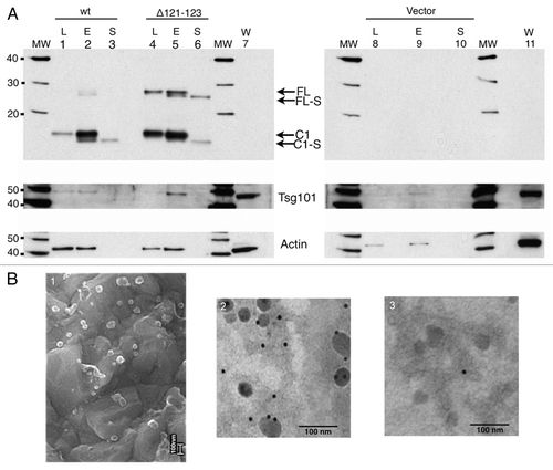 Figure 3. PrP with GPI-anchor is shed in association with exosomes. (A) Western immunoblot detection with the C-terminal antibody L42. Cell lysates (L; lanes 1, 4 and 8), 100,000 x g pelleted exosomal fractions (E; lanes 2, 5 and 9), and 100,000 x g supernatant fractions (S; lanes 3, 6 and 10) from cells transiently expressing PrPwt (lanes 1–3), PrPΔ121-123 (lanes 4–6), and vector control (lanes 8–10). Untransfected control cell lysates (W; lanes 7 and 11) are indicated. The same PVDF membrane was stripped and reprobed with antisera against Tsg101 and actin, respectively (below). The representative western blot displayed is one of three experiments. All samples were treated with PNGase F. Molecular mass markers are indicated (MW) and given in kDa. (B) The 100,000 x g pelleted exosomal fraction was analyzed by scanning electron microscopy (SEM) (panel 1) and immunogold transmission electron microscopy (TEM) (panels 2 and 3). PrP was detected by mAb L42 (panel 2). Unspecific antibody (antiBLV-gp51 (panel 3). Secondary antibody was gold-conjugated anti-mouse mAb (10 nm gold particles). Bars indicate 100 nm.