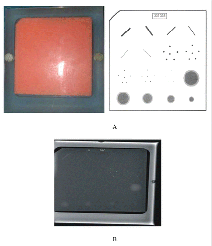 Figure 1. (A) The American College of Radiology (ACR) accreditation mammographic phantom, model 156, had an acrylic (PMMA) block that contained replaceable wax, which approximated a 4.0–4.5 cm-thick compressed breast. The wax contained target structures, comprising (1) 6 fibrils; (2) 5 groups of micro-calcifications and (3) 5 nodules of decreasing diameters and thicknesses, all arranged in a 4×4 matrix. (B) the optimal X-ray image of the phantom.