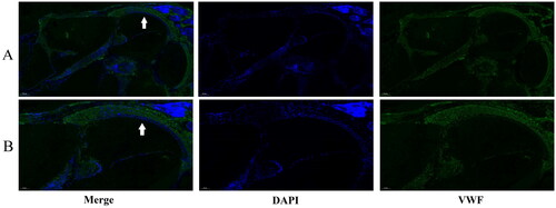 Figure 7. Immunofluorescence staining of VWF in c57BL/6 mouse cochlea. (A is 100×, B is 200×. The white arrows indicate the spiral ligament).