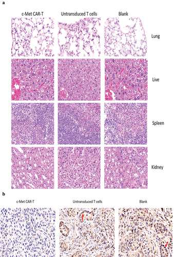Figure 9. HE and immunohistochemical staining of internal organ and subcutaneous transplanted tumors was performed in 3 groups. Internal organ and Tumor specimens were collected on day 30; (a) HE staining was performed to evaluate the pathological changes of lung, liver, kidney and spleen tissue from the 3 group (×400); (b)c-Met was mainly located in the cytoplasm and on the surface of A549 cells. Strong and diffuse expression of c-Met in Blank group and untransduced T cells group (Cells membrane and cytoplasm stained in yellow brown were the positive pattern, red arrow). c-Met CAR-T group with poor expression of c-Met(× 400); (c) IHC staining of Ki-67 in 3 groups of A549 cell xenograft tumors; The morphological change of apoptosis was observed by TUNEL method(Cells nucleus stained in yellow brown were the positive pattern, red arrow). (×400).