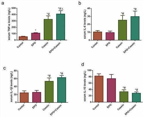 Figure 3. Levels of inflammatory factors in the serum of rats in each group. Rats were injected intraperitoneally with 2000 U/Kg/W of EPO three times per week or subcutaneously with 10% casein (1.2 g/kg), lasting 20 weeks. (a-d) The levels of TNF-α, IL-6, IL-1β and IL-10 in serum were detected using ELISA kits. The results were expressed as mean ± SD; n=5. *p<0.05 vs. Control group, # p<0.05 vs. EPO group, Δ p<0.05 vs. Casein group.