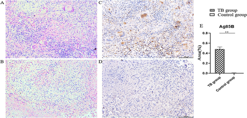 Figure 1 Pulmonary tuberculosis pathological staining. (A and B) Distal side control group and TB group hematoxylin and eosin staining (×200). (C and D) Ag85B IHC staining of distal side control and TB group (×200). (E) Ag85B IHC staining results statistical analysis.(**P < 0.01).
