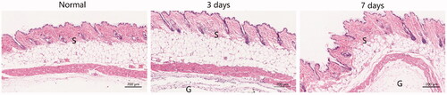 Figure 7 HE-stained images of skin tissue after subcutaneous injection of thermogel (20 wt%) at predetermined time points. S: skin tissue; G: thermogel. The scale bar is 200 μm.