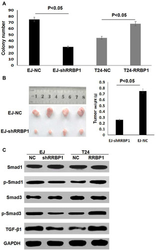 Figure 4 RRBP1 overexpression promoted cell proliferation in vivo. (A) RRBP1 overexpression promoted colony formation. (B) RRBP1 knockdown inhibited the growth of bladder cancer xenografts in vivo. (C) RRBP1 overexpression activated the TGF-β/Smad pathway.