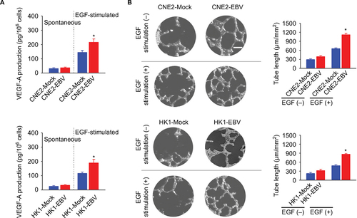 Figure 2 EBV infection promotes EGF-stimulated VEGF production and endothelial tube formation.Notes: (A) VEGF-A production was determined in the mock-controlled and the EBV-infected CNE2 or HK1 cell-conditioned medium. The amount of VEGF released from the serum-starved cells in the absence or presence of extracellular EGF stimulation was determined by ELISA. (B) HUVECs were incubated with the cell-conditioned medium as indicated. Representative photographs of HUVEC tube formation were captured at 6 hours after cell seeding; scale bar =100 μm. The tube formation was quantitatively evaluated by calculating the tube length per standard area in each well (right panel). The data are representative of three independent experiments and are presented as the mean ± SEM (*P<0.05, Student’s t-test).Abbreviations: EBV, Epstein–Barr virus; EGF, epidermal growth factor; ELISA, enzyme-linked immunosorbent assay; HUVECs, human umbilical vein endothelial cells.