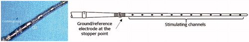 Figure 39. Electrode array that carries a reference electrode at the stopper point. Image courtesy of MED-EL.