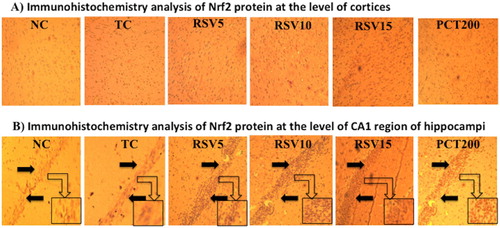 Figure 7. Immunohistochemistry analysis of Nrf2 protein by fluorescent microscope in coronal brain sections at 10x magnification. (A) Schematic illustration of cortices in groups by immunohistochemical staining for Nrf2. The profound expression of re Nrf2 were observed in TC group as compared to NC group, treatment groups of rosuvastatin and piracetam have shown effect on staining of nrf2. (B) Immunohistochemical staining for Nrf2 at the level of CA1 region of hippocampus. The profound expression of nuclear Nrf2 were observed in TC group as compared to NC group, treatment groups of rosuvastatin and piracetam have shown effect on staining of nrf2. Black arrows are showing the positively stained cells.