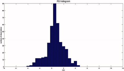 Figure 5. Frequency distribution of the signed RS for all patients, in which the normal distribution of the RS can be observed. Example of dose profile with R80 for pCT and CT, and the relative RS.