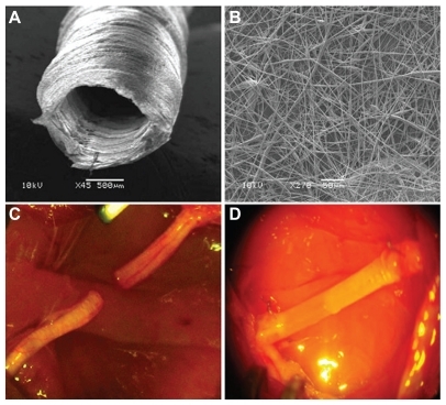 Figure 12 Experimental model. Scanning electron microscopy images of the electrospun poly-D,L-lactic acid/polycaprolactone nerve guide conduit (A) and magnified details of the tube wall (B) microfibers and nanofibers range in diameter from approximately 280 nm to 8 μm. The nonwoven fibrous microstructure is characterized by small pores (700 nm) and large pores (20 μm). C) Micrograph of sham-operated rat sciatic nerve (experimental Group 1). D) Micrograph of prosthesis implanted, filled with saline solution, and sutured to the transected nerve (experimental Group 3).