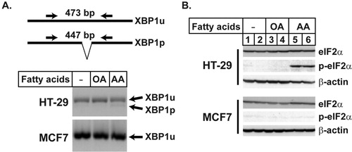 Figure 4. AA induced ER stress in HT-29 cells. The cDNAs prepared for the experiment described in Figure 3 were used to determine XBP1 processing. Equal amount of the PCR reaction of the individual samples in each group were pooled and separated on a 2% agarose gel. The unprocessed (XBP1u) and processed (XBP1p) forms of XBP1 generated 473 and 447 bp bands, respectively. (B) Total eIF2α and the phosphorylated eIF2α were determined by immunoblotting in the cells treated with the indicated fatty acids. β-actin is used as the loading control.