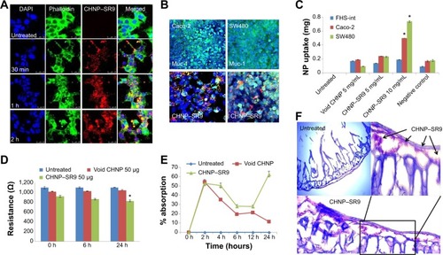 Figure 4 Internalization of CHNP–SR9 in Caco-2 cells.Notes: (A) It was observed that the CHNP efficiently internalized in Caco-2 cells within a 2-hour period. (B) Both Caco-2 and SW480 cells showed high expression of mucin-1 (Muc-1) receptor, which played an important role in the internalization of the CHNP. (C) CHNP–SR9 showed significantly higher uptake in cancer cells when compared to non-cancerous cells. (D) The resistance values of the millicell inserts with treated and untreated cells showed that CHNP–SR9 treatments lowered the resistance of Caco-2 monolayer. (E) The ex vivo loop assay results showed that the maximum absorption of CHNP was observed at 24 hours in the jejunum. (F) The CHNP were observed in various regions of the rat intestinal sections, confirming its non-toxic and mucoadhesive nature. The black arrows mark the presence of CHNP-SR9 in the intestinal sections. *P<0.05.Abbreviations: CHNP, chitosan nanoparticles; SR9, cell-permeable dominant negative survivin SurR9-C84A; min, minutes; h, hours; DAPI, 4′,6-diamidino-2-phenylindole; NP, nanoparticle Caco-2, colon adenocarcinoma cells; SW480, colon adenocarcinoma cells; FHS 74 Int, human small intestinal cells.