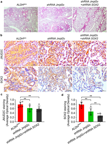 Figure 6. The micrometastases was reduced in mouse lung tissues injected with Jmjd2c-silenced and Jmjd2c-SOX2-silenced ALDHbri+ CSCs. (a) The HE staining results revealed the micrometastases in different groups. (b) The protein expressions of Jmjd2c and SOX2 with Jmjd2c silence or Jmjd2c-SOX2 silence from immunochemistry in mouse lung tissues. (c) and (d) quantification of the results in B. Bars = 100 μm.In A, 50 μm in B. Data were represented as means±SD, n ≥ 3; **p < 0.01.