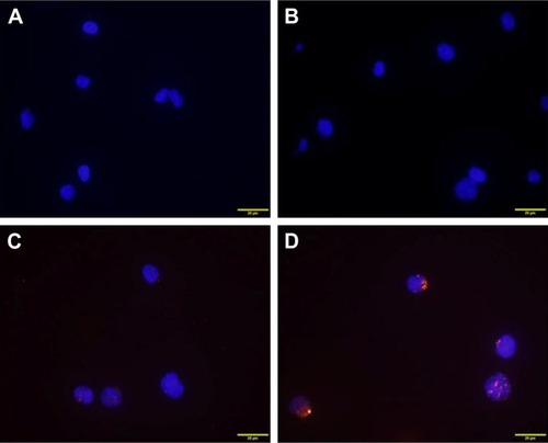 Figure 2 Intracellular distribution of DNR in leukemia K562 cells in control (A), NP (B), DNR (C), and DNR-loaded NP (D) groups under fluorescence microscopy (×400).