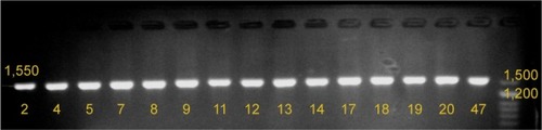 Figure 2 Results of agarose gel electrophoresis of mtDNA control region PCR products.