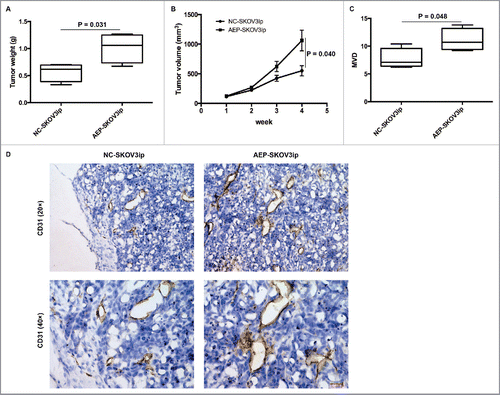 Figure 4. AEP-SKOV3ip cells promote growth potential in mice subcutaneous model. (A) The tumor weights (g) of AEP-SKOV3ip group were significant heavier than that of NC-SKOV3ip group. (B) The tumor volumes of AEP-SKOV3ip group were larger than that of NC-SKOV3ip group. (C) The MVD of AEP-SKOV3ip group was significant higher than that of NC-SKOV3ip group. (D) The expression of MVD in AEP-SKOV3ip and NC-SKOV3ip group was evaluated by immunohistochemistry at ×200 magnifications. Scale bar, 100µm.