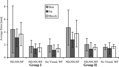 Figure 4. Average error in mm when visual feedback is limited, with and without force feedback. NN=no needle, WN=with needle, NF=no force, and WF=with force.
