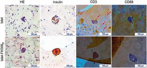 Figure 5. Immunohistochemistry analysis. H&E staining shows intact morphology of the islets inside the Matrigel of islet–FK506M group. In addition, intense stain due to insulin was observed in the islet–FK506M group compared to that of islet recipients. Higher proportion of CD3 (indicated by arrows) and CD68 (indicated by arrows) positive cells were observed in islet group compared to that of the islet–FK506M group. In islet recipients, the Matrigel was retrieved on day 15 post-transplantation. In islet–FK506M recipients, the Matrigel was retrieved on day 30 post-transplantation.