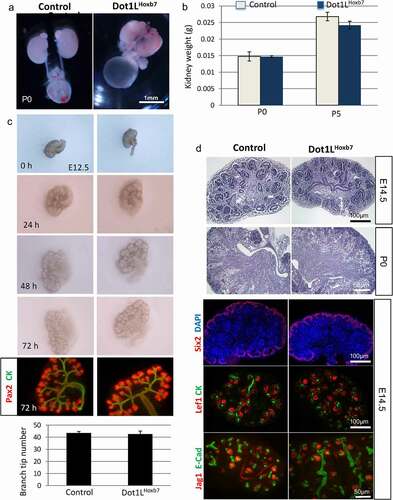 Figure 2. Dot1L-H3K79me is dispensable for ureteric bud branching and formation of the collecting system. (a) Gross morphology of the urinary tracts. Dot1LHoxb7 pups have normal appearing kidneys, ureters and bladder. (b) Kidney weights are similar in control and Dot1LHoxb7 newborns at P0 and P5 (n = 6–8 per group). (c) In vitro culture of E12.5 metanephroi reveals that inactivation of Dot1L in the ureteric bud lineage has no discernible effect on normal growth and branching (n = 5/group). (d) Histological examination and immunostaining of nephron progenitors (Six2), nascent nephrons (Lef1, Jagged1), and collecting ducts (CK, E-Cadherin) show normal nephron differentiation (n = 4/group)