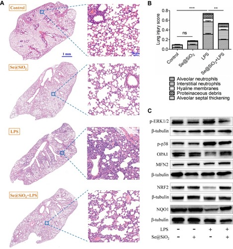Figure 6 Protective effects of porous Se@SiO2 NPs on diffuse lung injuries of ALI mice. (A) The typical histological photos of the lung sections stained with H&E in each group. The scale bar in the left panel represents 1 mm while that in the right panel represents 50 μm. (B) Lung damage in each group was evaluated by five pathophysiological features to get the total score. (C) The impact of Se@SiO2 NPs on the expression of several proteins in lung tissues of ALI mice. NP concentration = 100 μg/Kg, LPS = 10 mg/Kg, ns = not significant, **p < 0.01, ***p < 0.001.