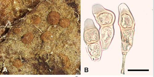 Figure 15. Puccinia lagenophoricola on Lagenophora pumila: A, Telia. B, Teliospores. Scale bar = 20 μm.