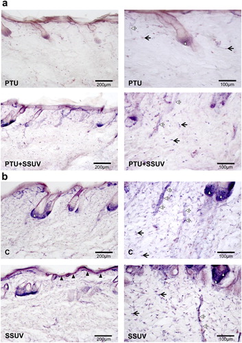 Figure 2. NADPH-d reactivity in hypothyroid (PTU) (a), and euthyroid (C) (b) rat’s skin, with or without SSUV exposure. Black arrows indicate dermal fibroblasts, black arrowheads – keratinocytes in epidermis, white arrowheads – epithelial cells of hair root follicles, white arrows – blood vessels. The positive cells are visualized with dark blue color.