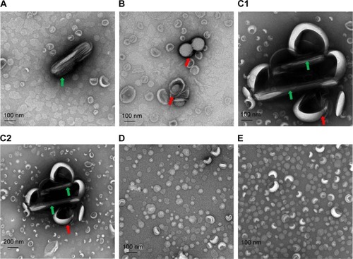 Figure 2 TEM analysis of PTX-loaded liposomes.Notes: TEM images of (A–C) PTX-loaded/C300(−) DMPC:CHOL:PE-PEG liposomes prior to separating unloaded PTX (A), stored for 1 day at 4°C (B) and 7 days at 25°C (C), (D, E) PTX-loaded/C300(+) DMPC:CHOL:PE-PEG liposomes stored for 1 day at 4°C (D) and 7 days at 25°C (E). Rod-like PTX crystals and the fusion or aggregation of liposomes were indicated green and red arrow, respectively. TEM images in (C) were shown using both 100 (C1) and 200 nm (C2) scale for comparison.Abbreviations: C300, Captex 300; CHOL, cholesterol; DMPC, 1,2-dimyristoyl-sn-glycero-3-phosphocholine; PE-PEG, N-(Carbonyl-methoxypolyethyleneglycol 2000)-1, 2-distearoyl-sn-glycero-3-phosphoethanolamine; PTX, paclitaxel; TEM, transmission electron microscopy.