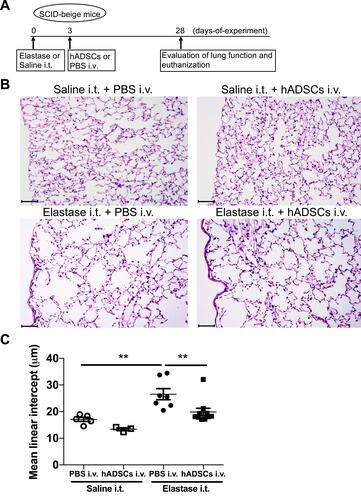 Figure 1 hADSCs suppress elastase-mediated lung histological changes in SCID-beige mice.