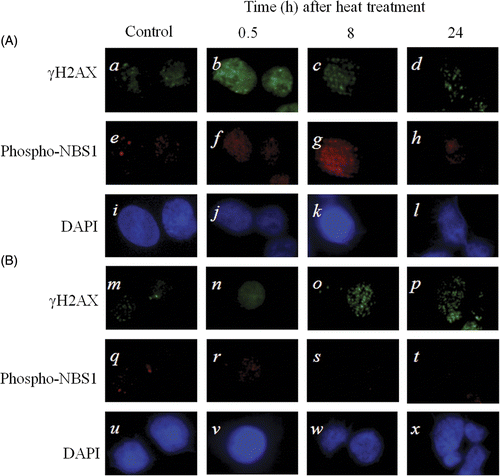 Figure 5. Typical photograph of γH2AX and phospho-NBS1 in 8305c cells after heat treatment at 44°C for 40 min. (A) The scrambled siRNA transfected cells. (B) The NBS1-siRNA transfected cells; (a-d and m-p) γH2AX; (e-h and q-t) phospho-NBS1; (i-l and u-x) DAPI.