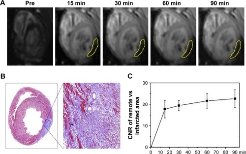 Figure 4 (A) Representative in vivo MRI and (B) Masson-stained tissue section of the infarcted heart with the administration of MnO-PEG-Cy5.5 nanoparticles by tail vein injection. (C) CNR of remote vs. infarcted myocardium of three rats during the first 90 minutes after MnO-PEG-Cy5.5 nanoparticles injection. Data are expressed as means ± SD.Note: Yellow circles indicate the hypoenhancement of the infarcted myocardium.Abbreviations: CNR, contrast-to-noise ratio; MI, myocardial infarction; MRI, magnetic resonance imaging.