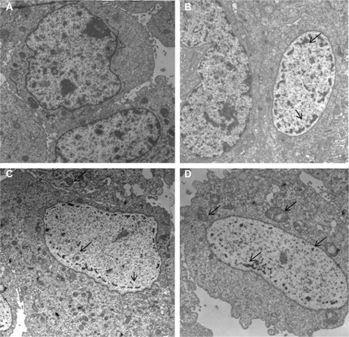 Figure 6 Ultrastructural analysis of MCF-7 cells.Notes: MCF-7 parental cells showed a large nucleus and a light cytoplasmic complexion containing well-preserved organelles including mitochondria (A). Treatment with free DOX (43.1 μM for 1 hour) induced nuclear alteration (arrows) (B). However, exposure of MCF-7 to DOX-loaded PBCA NPs at the same concentration and for the same time period resulted in major damage to the nuclei and produced a large number of altered mitochondria with disrupted cristae (arrows) (C and D). All images are at a 2,000× magnification.Abbreviations: DOX, doxorubicin; PBCA NPs, poly(butylcyanoacrylate) nanoparticles.