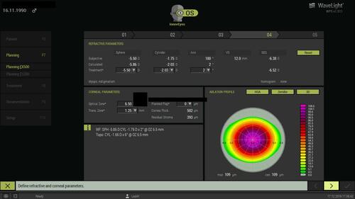 Figure 2 Customized treatment profile employed in the Innoveyes treatment for the same eye noted in. Figure 1, as illustrated by the EX500 excimer laser treatment Innoveyes software. The software overview of the suggested treatment following the noted ray tracing calculations in the case described in Figure 1.