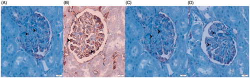 Figures 3. NF-kB/p65 IHC staining. Imunolocalization of NF-kB/p65 (B) and caspas-3 (F) positive mesangial cells, examined under light microscopy, from renal cortex. (A) Control group. (B) OVX group. (C) Ovx + bortezomib group. (D) OVX +17β-estradiol group. Original magnification × 40.