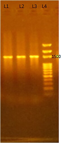 Figure 6. Gel electrophoresis of molecular amplification of 16S rRNA gene of bacterial DNA using a universal primer (1500 bp) in 1% agarose gel. L1: R2 bacteria, L2: R3 bacteria, L3: R4 bacteria and L4: ladder 100 bp.