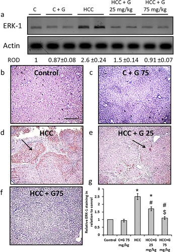 Figure 10. Effect of genistein at 25 and 75 mg/kg on hepatic ERK-1 protein expression levels in TAA-induced HCC rats. (a) ERK-1 protein expression levels were determined via western blotting. (b) Photomicrographs of immunohistochemically stained hepatic sections using anti-ERK-1 antibodies in the following groups: (b) Control group; (c) control group treated with genistein at 75 mg/kg; (d) HCC group; (e) HCC rats treated with 25 mg/kg genistein; and (f) HCC rats treated with 75 mg/kg genistein respectively. (g) Relative immune-staining score of ERK-1 showing increase in HCC sections that was reduced by genistein treatment. Scale bars, 100 µm. *P < 0.05 vs. control group; #P < 0.05 vs. HCC group; $P < 0.05 vs. HCC + 75 mg/kg genistein group. TAA, thioacetamide; HCC, hepatocellular carcinoma; C, control; G, genistein.