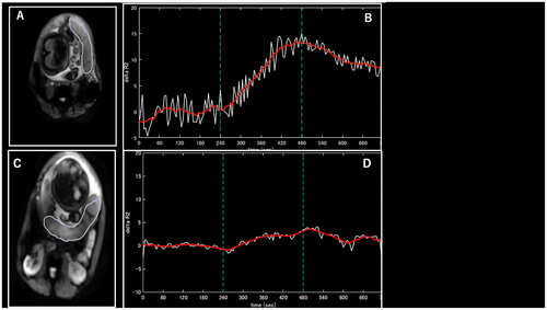 Figure 1. (A, B) Normal pregnancies and (C, D) pregnancies with a history of COVID-19 disease. (A, C) Diagrams of placental area designation. (B, D) Changes in ΔR2* values with maternal oxygen administration. Maternal oxygen is administered between 240 and 480 s, indicating increased ΔR2* values.