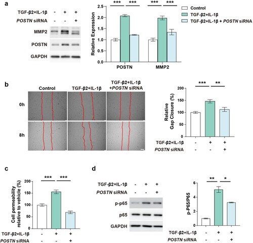 Figure 4. POSTN knockdown ameliorates ECM deposition and endothelial function.: a, Protein expression of MMP2 after TGF-β2 (10 ng/mL) and IL-1β (1 ng/mL) co-treatment for 5 days with or without POSTN knockdown (2 nM). b, Migration assay after TGF-β2 (10 ng/mL) and IL-1β (1 ng/mL) co-treatment with or without POSTN knockdown (10 nM). Scale bar = 200 µm. c, Permeability assay after TGF-β2 (10 ng/mL) and IL-1β (1 ng/mL) co-treatment with or without POSTN knockdown (5 nM). d, Protein expression of phosphorylated p65 by co-treatment of TGF-β2 (10 ng/mL) and IL-1β (1 ng/mL) for 24 h with or without POSTN siRNA (5 nM) transfection. P < 0.05, ** P < 0.01, *** P < 0.001, as determined by unpaired two-tailed Student’s t-test or one-way ANOVA with Bonferroni’s multiple comparison test. Error bars represent S.E.M.