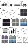 Figure 2 Altered NLPR3 expression modulated the proliferation, clonogenicity, migration, and invasion in endometrial cancer cells. Ishikawa and HEC-1A cells were transduced with lentivirus for NLPR3 silencing. (A) Western blot analysis of relative NLRP3 levels in NLRP3 silence cells. The proliferation (B), clonogenicity (C), invasion (D), and wound healing (E) in different groups of cells were determined. Ishikawa and HEC-1A cells were transduced with lentivirus for NLPR3 overexpression. (F) Western blot analysis of relative NLRP3 levels in NLRP3 overexpressing cells. The relative levels of NLPR3, IL-1β, and caspase-1 were determined by Western blot. Data are representative images or expressed as mean ± SEM of each group from three separate experiments. The proliferation (F), migration (mig, G), and invasion (inva, H) in different groups of cells were determined. (I) Caspase-1 inhibitor YVAD-cmk inhibits the proliferation of endometrial cells. *P<0.05, **P<0.01, ***P<0.001.Abbreviations: ISK, Ishikawa; Casp-1, Caspase-1.