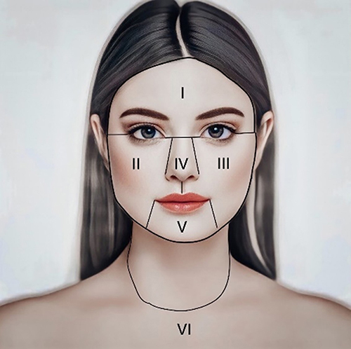 Figure 1 The six (I-VI) locations of Thai Global Acne Grading System (TGAGS).