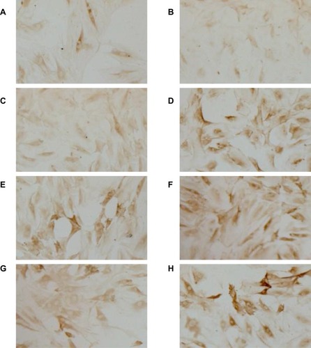 Figure 2 Immunohistochemistry staining for VEGFA protein in BMEC. Representative light microscopy images (×100) of the effect of AdHIF-1α on VEGFA protein level in BMEC at 12 h (A) and 48 (B) in the normoxia group, at 12 h (C) and 48 h (D) in the hypoxia group, at 12 h (E) and 48 h (F) in the AdHIF-1α group, and at 12 h (G) and 48 h (H) in the Ad group, respectively.