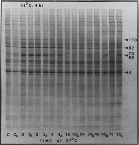 Figure 2. An autoradiograph of [35S]methionine labelled proteins obtained in one set of experiments. SQ-1 cells were exposed to 41°C for 4 h, incubated at 37°C for various time periods, and (a) labelled, (b) or heated at 43.5° for 15 min, and then labelled. Lanes are designated by the time period (in number of hours) for which the cells were placed at 37°C; lanes representing (b) are marked with an additional subscript Δ. The lanes marked C and CΔ are for control cells, i.e. cells which did not receive a priming heat dose.