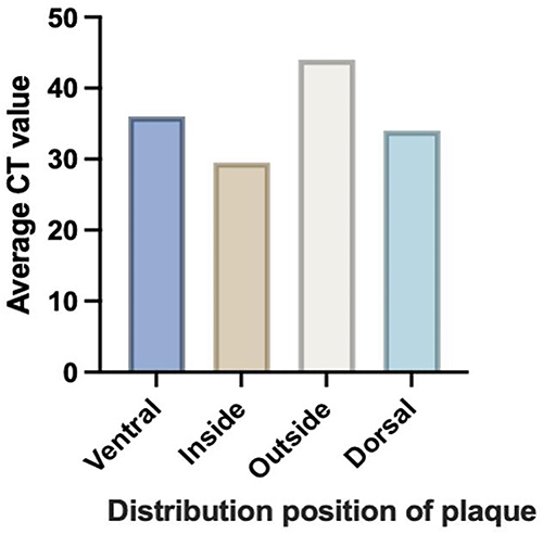 Figure 4 Shows the average CT values of plaques with different distribution locations in the high-risk plaque group, Error bars represent the mean with SEM (standard error of mean) of the four data sets. There was no statistical significance was analyzed using two-way ANOVA, (P>0.05).