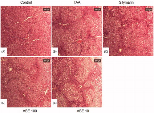 Figure 5. Haematoxylin and eosin stain of liver tissues. At the end of the experiment, all of the animals were sacrificed and livers were fixed in Bouin’s solution. After staining with haematoxylin and eosin, liver sections were taken under light microscopy. Control: naive rats (A), TAA: TAA-induced liver fibrosis rats (B), Silymarin: Positive control rats (C), ABE 100: ABE 100 mg/kg treated rats (D), ABE 10: ABE 10 mg/kg treated rats (E), Scale bar =200 μM.