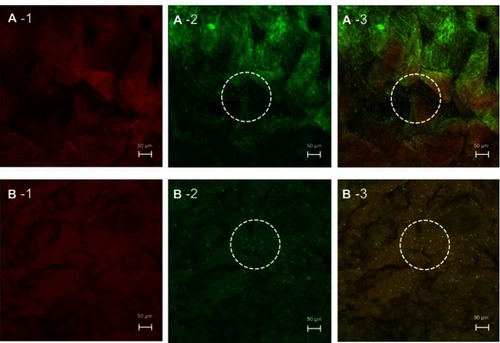 Figure 7 CLSM (x–y plane) images show a porcine intestine treated with Nile red-loaded NBD-PE-labeled microemulsion after (A) 2 h and (B) 4 h. Each image is divided into three frames as follows: (1) red fluorescence of Nile red, (2) green fluorescence of NBD-PE-labeled microemulsion particles and (3) overlay of 1 and 2. The scale bar represents 50 µm. The dash circles indicate a group of microemulsion particles from which the entrapped drugs were released into the tissues.