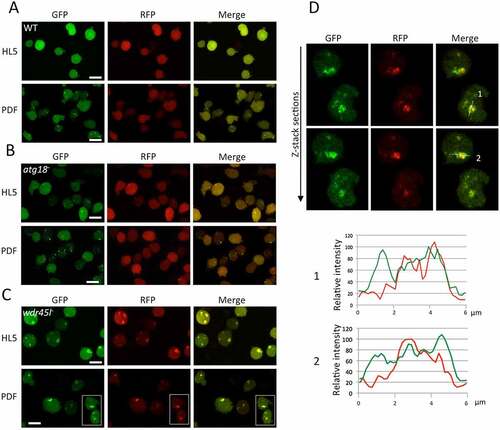 Figure 3. Analysis of autophagy by confocal microscopy.